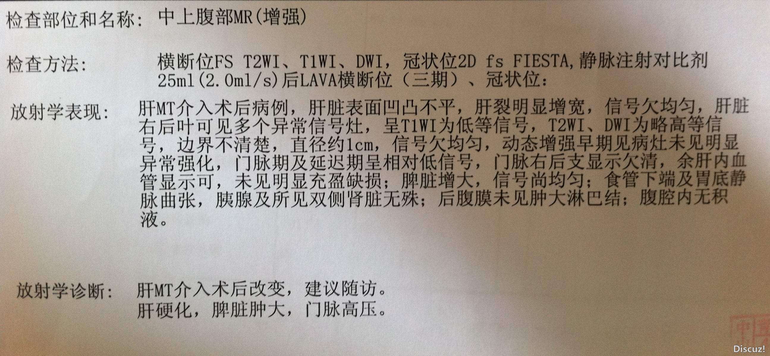 核磁共振报告