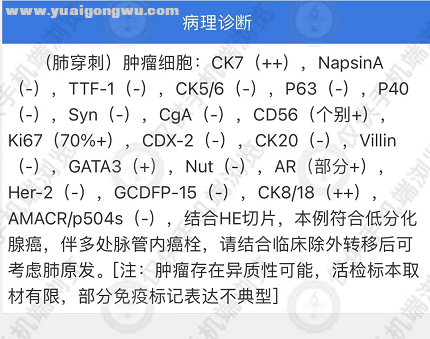 CA类型诊断